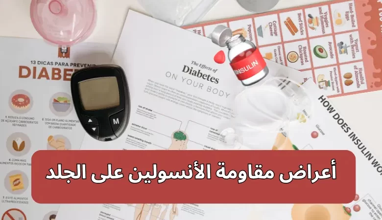 أعراض مقاومة الأنسولين على الجلد